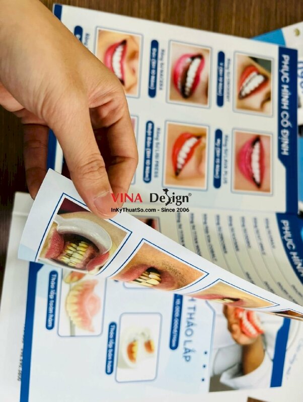In menu nha khoa, in cuốn menu dịch vụ niềng răng - VND407