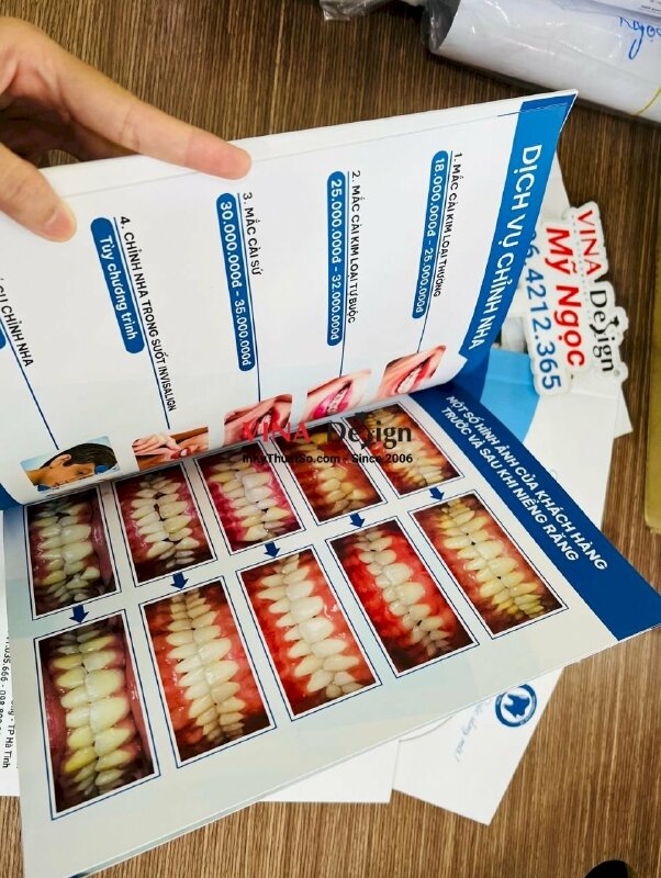 In menu nha khoa, in cuốn menu dịch vụ niềng răng - VND407