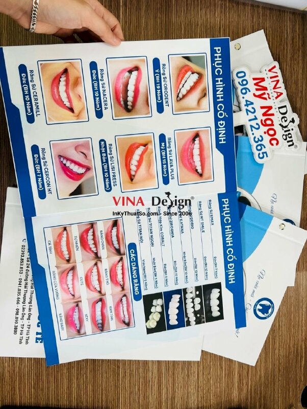 In menu nha khoa, in cuốn menu dịch vụ niềng răng - VND407